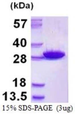 SDS-Page: Recombinant Human Glutathione S-transferase Mu 5 Protein [NBP1-98932] - 15% SDS-PAGE (3ug)