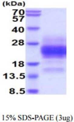 SDS-PAGE Recombinant Human Glycophorin A His Protein