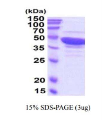 Recombinant Human Guanine deaminase Protein [NBP2-49692]