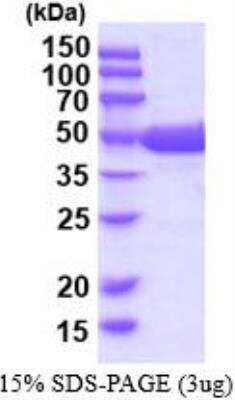 SDS-Page: Recombinant Human Guanine deaminase Protein [NBP2-52618]