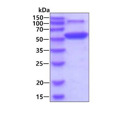 SDS-Page: Recombinant Human HARS His Protein [NBP1-48599] - 3ug by SDS-PAGE under reducing condition and visualized by coomassie blue stain.