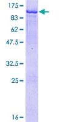 SDS-PAGE Recombinant Human HBS1L GST (N-Term) Protein