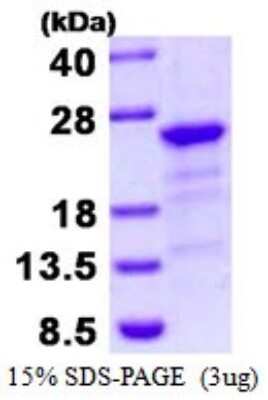 SDS-PAGE Recombinant Human HBXIP His Protein