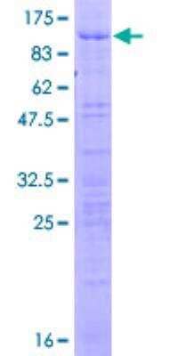 Recombinant Human HCC1 Protein [H00009584-P01] - 12.5% SDS-PAGE Stained with Coomassie Blue.