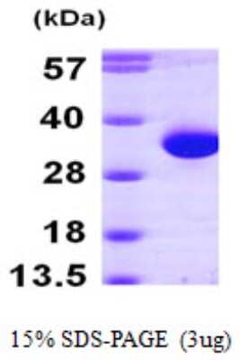 SDS-PAGE Recombinant Human HDHD2 His Protein