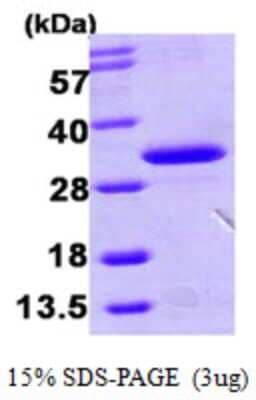 SDS-Page: Recombinant Human HDHD3 Protein [NBP1-51017] - 15 % SDS-PAGE (3ug)