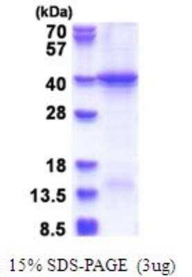 SDS-PAGE Recombinant Human HERC5 His Protein