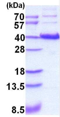 SDS-Page: Recombinant Human HIF-1 alpha Protein [NBC1-18422] - 3ug by SDS-PAGE under reducing condition and visualized by coomassie blue stain