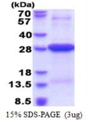 SDS-PAGE Recombinant Human HLA DRA His Protein