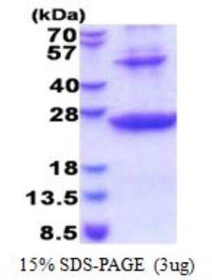 SDS-PAGE Recombinant Human HLA DRB1 His Protein