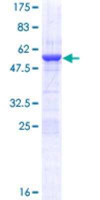 SDS-Page: Recombinant Human HMGB1/HMG-1 Protein [H00003146-P01] - 12.5% SDS-PAGE Stained with Coomassie Blue.