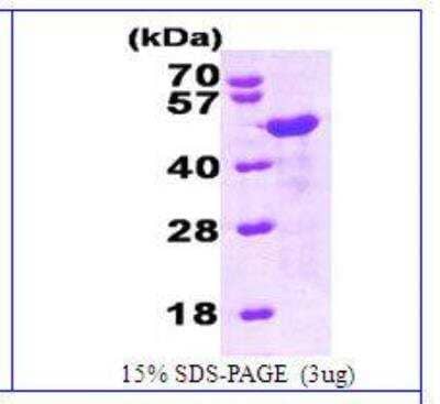 SDS-Page: Recombinant Human HOMER1 Protein [NBC1-26371]