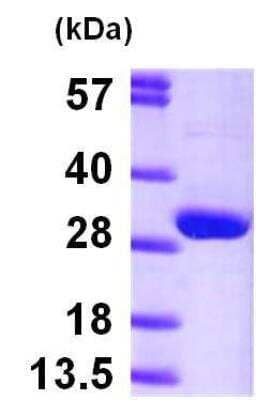 Western Blot: Recombinant Human HPRT Protein [NBP1-45251]