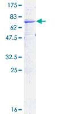 SDS-Page: Recombinant Human HSD11B2 Protein [H00003291-P01] - 12.5% SDS-PAGE Stained with Coomassie Blue.