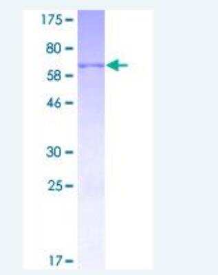 SDS-Page: Recombinant Human HSD3B1 Protein [H00003283-P01] - 12.5% SDS-PAGE Stained with Coomassie Blue.