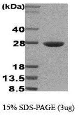 SDS-PAGE Recombinant Human HSP27 Protein