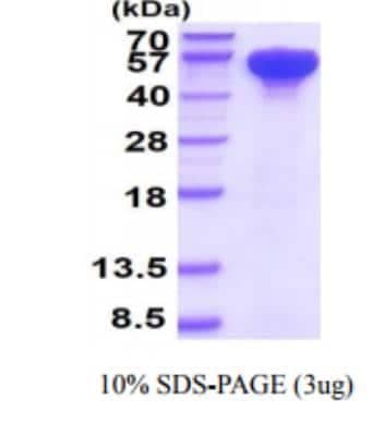 Recombinant Human HSP70/HSPA1A Protein [NBC1-18367]