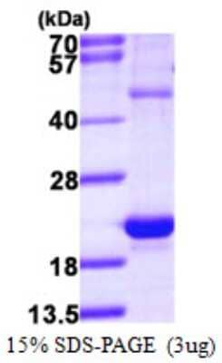 SDS-Page: Recombinant Human HSPB3 Protein [NBP1-78810] - 15% SDS-PAGE (3ug)