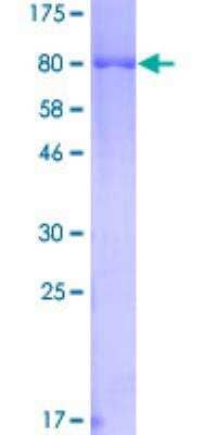 SDS-PAGE Recombinant Human Hck GST (N-Term) Protein