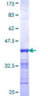 SDS-Page: Recombinant Human Helios Protein [H00022807-Q01] - 12.5% SDS-PAGE Stained with Coomassie Blue.