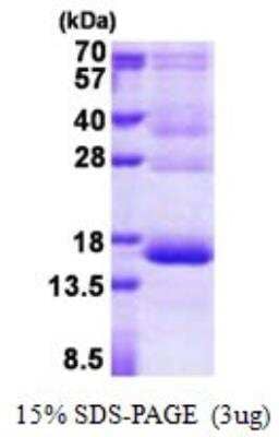 SDS-PAGE Recombinant Human HBG1/2 His Protein