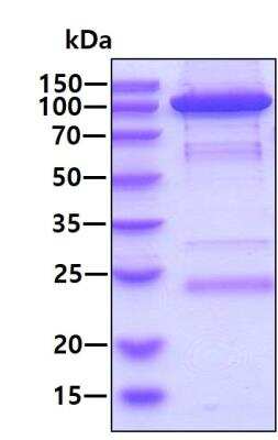 SDS-Page: Recombinant Human Hexokinase 1 Protein [NBC1-18390] - 3ug by SDS-PAGE under reducing condition and visualized by coomassie blue stain