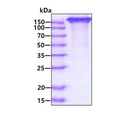 SDS-PAGE Recombinant Human ICAM-5 hIgG-His Protein