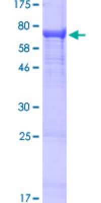 SDS-Page: Recombinant Human IGHV4-31 Protein [H00028396-P02] - 12.5% SDS-PAGE Stained with Coomassie Blue.