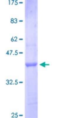 SDS-Page: Recombinant Human IL-1 RAPL1/IL-1 R8 Protein [H00011141-Q01] - 12.5% SDS-PAGE Stained with Coomassie Blue.