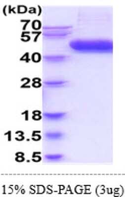 SDS-Page: Recombinant Human IL-1 RII Isoform 1 Protein [NBP2-61984] - 15% SDS-PAGE (3ug)