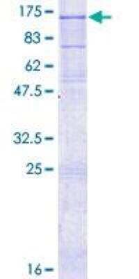 SDS-Page: Recombinant Human IL-12 R beta 2 Protein [H00003595-P01] - 12.5% SDS-PAGE Stained with Coomassie Blue.