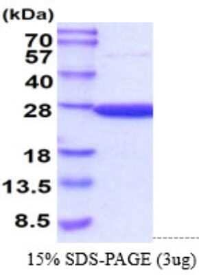 SDS-Page: Recombinant Mouse Peroxiredoxin 2 Protein [NBP2-61185] - 15 % SDS-PAGE (3ug)