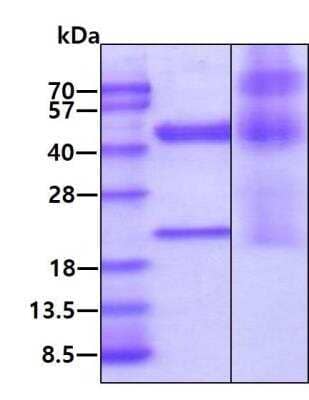 SDS-Page: Recombinant Human IL-23 Protein [NBP2-80388] - 3ug by SDS-PAGE visualized by coomassie blue stain.Lane 1 : reducing condition. Lane 2 : non-reducing condition.