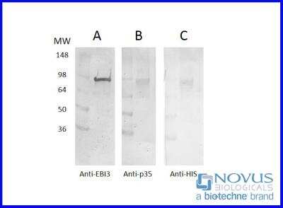 Western Blot: Recombinant Human IL-35 Protein [NBP2-76231] - 3 ug of purified recombinant human IL-35 per lane under reducing conditions in a 4-20% Tris-glycine gel.  Samples analyzed via western blot (A) Rabbit anti-mouse EBI3 subunit, (B) Mouse anti-human p-35, (C) Mouse anti-HIS.