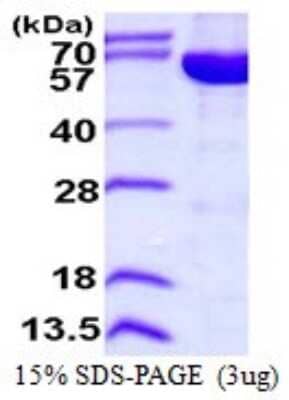 SDS-Page: Recombinant Human IMP Dehydrogenase 2/IMPDH2 Protein [NBP1-72513] - 15% SDS-PAGE (3ug)