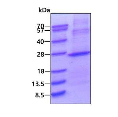 SDS-PAGE Recombinant Human IMP3 His Protein