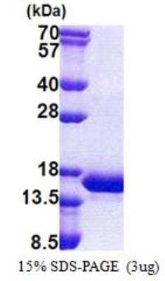 SDS-PAGE Recombinant Human INCA His Protein