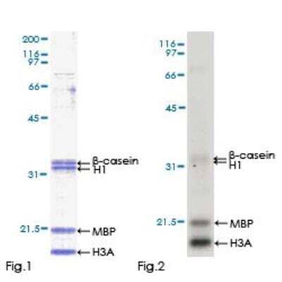 Functional: Recombinant Human IRAK4 Protein [H00051135-P01]