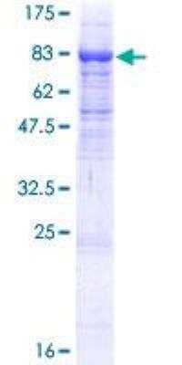 SDS-Page: Recombinant Human ITFG1 Protein [H00081533-P01] - 12.5% SDS-PAGE Stained with Coomassie Blue.