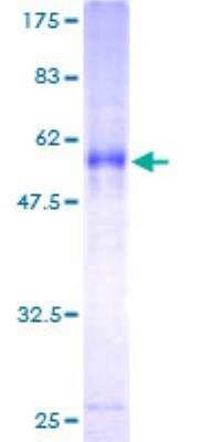 Unknown Recombinant Human ITM2A GST (N-Term) Protein