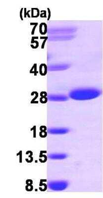 SDS-Page: Recombinant Human ITPA Protein [NBP1-45292] - 15% SDS-PAGE (3ug)