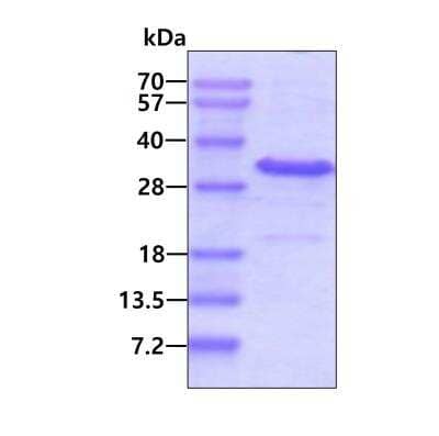 SDS-Page: Recombinant Human IYD His Protein [NBP2-51606] - 3ug by SDS-PAGE under reducing condition and visualized by coomassie blue stain.