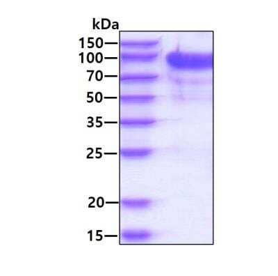 SDS-Page: Recombinant Human Importin beta/KPNB1 Protein [NBP1-78815] - 3ug by SDS-PAGE under reducing condition and visualized by coomassie blue stain.