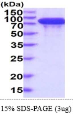SDS-Page: Recombinant Human Integrin beta 4/CD104 Protein [NBP2-61461] - 15% SDS-Page (3ug)