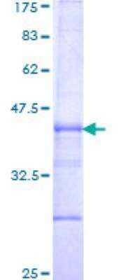 Unknown Recombinant Human Integrin beta 6 GST (N-Term) Protein