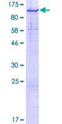 SDS-PAGE Recombinant Human JMJD1B GST (N-Term) Protein