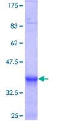 SDS-Page: Recombinant Human KBTBD10 Protein [H00010324-Q01] - 12.5% SDS-PAGE Stained with Coomassie Blue.