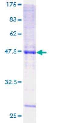 SDS-Page: Recombinant Human KCNMB2 Protein [H00010242-P01] - 12.5% SDS-PAGE Stained with Coomassie Blue.