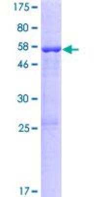 SDS-Page: Recombinant Human KCNRG Protein [H00283518-P01] - 12.5% SDS-PAGE Stained with Coomassie Blue.