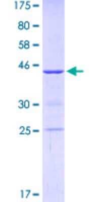 SDS-Page: Recombinant Human KIF1C Protein [H00010749-Q01] - 12.5% SDS-PAGE Stained with Coomassie Blue.